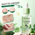 Bioaqua Centella Asiatica Soothing Repair Anti Acne Face Serum Essence 30ml