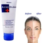 Mistine Acne Clear Facial Foam 85ml